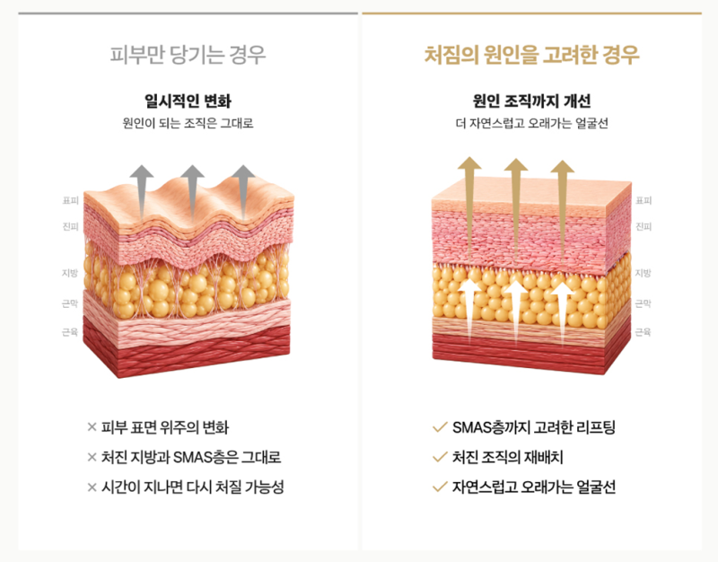 1mm(일미리)성형외과 페이스핏 미니거상