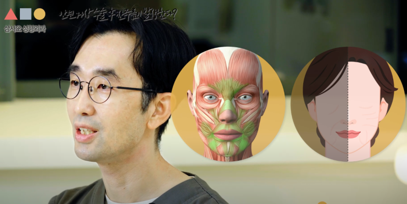 Panduan Lengkap Efek dan Masa Bertahan Facelift, Kemungkinan Operasi Ulang, serta Perhatian Khusus