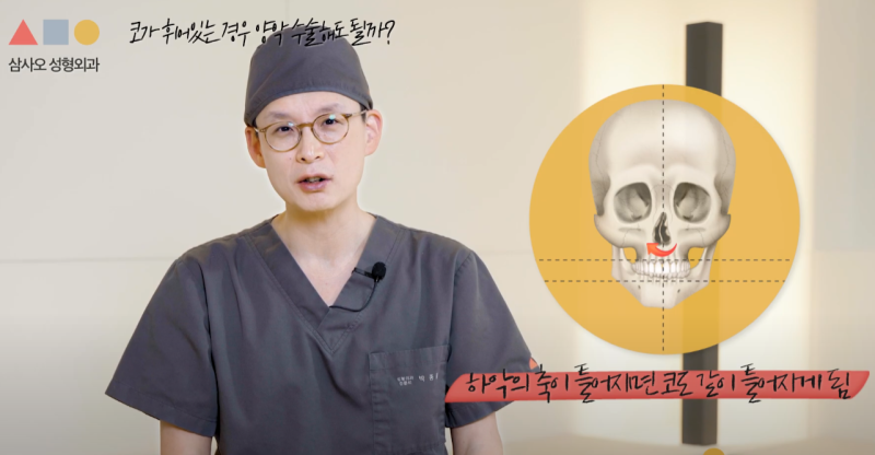 Koreksi Asimetri Wajah, Mana Pilihan yang Tepat untuk Saya Antara Operasi Kontur Wajah dan Operasi Ortognatik?