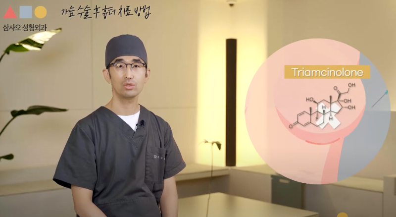 隆乳疤痕保養與治療方法：從雷射到穿著運動內衣