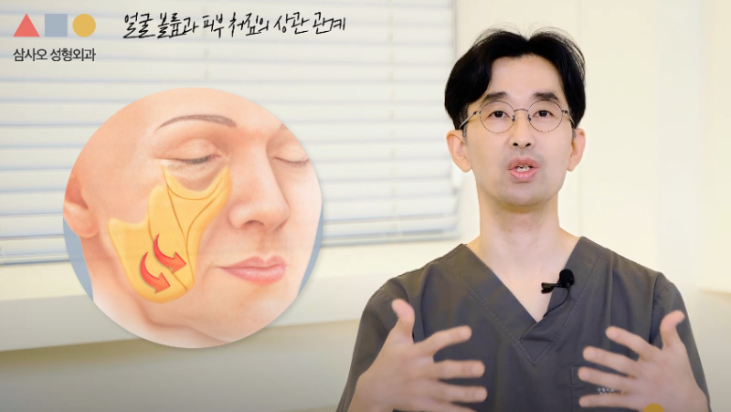 提升拉提效果的臉部容積調整重要性｜拉皮手術前注意事項