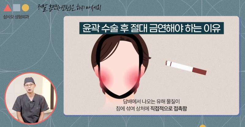 快速消除顏面輪廓腫脹的5個護理秘訣：縮短術後恢復期的方法