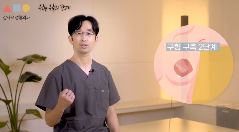 가슴구형구축 확률과 증상은? 가슴수술 전 꼭 알아야 할 부작용 정보