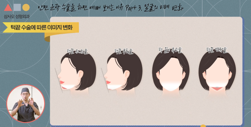 안면 윤곽 수술 후 더 예뻐 보이는 이유? 얼굴황금비율의 중요성