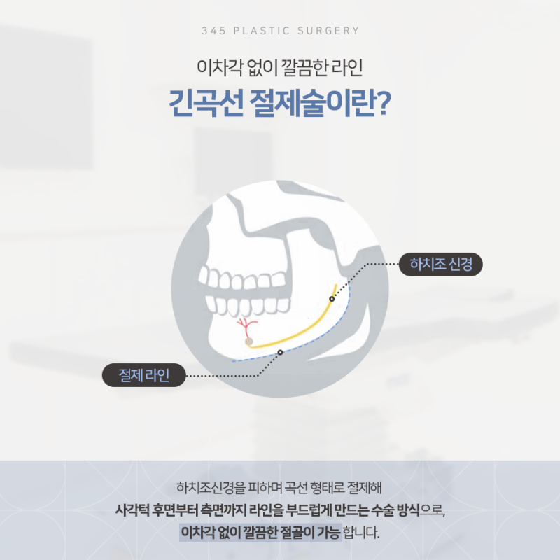 사각턱, 많이 깎는다고 예쁜 턱선이 될까요? 삼사오 긴곡선 사각턱 사진 3