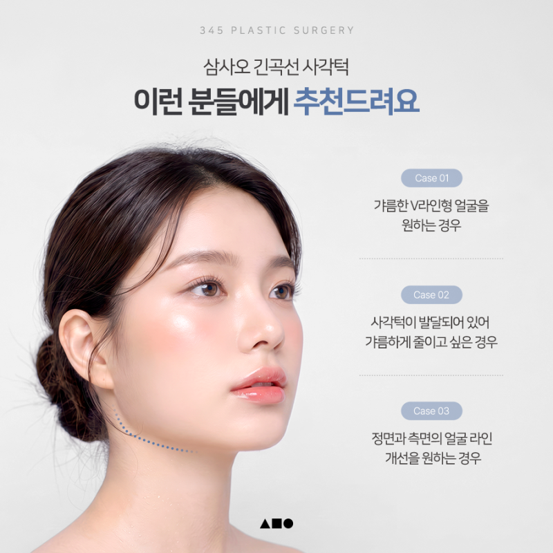 사각턱, 많이 깎는다고 예쁜 턱선이 될까요? 삼사오 긴곡선 사각턱 사진 6