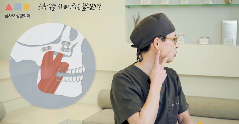윤곽, 양악 수술 후 레이저 시술 받아도 되나요? 뼈박사가 알려드립니다 사진 12
