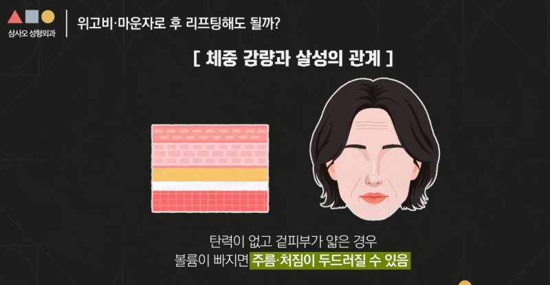 다이어트와 리프팅 중 어떤 것을 먼저해야 할까?  삼사오성형외과 알려드립니다