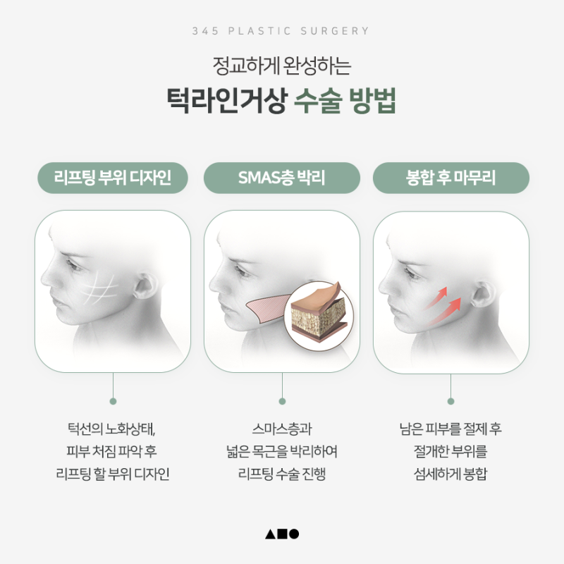 무너진 턱선을 자연스럽게, 턱라인거상 알아보기 사진 4