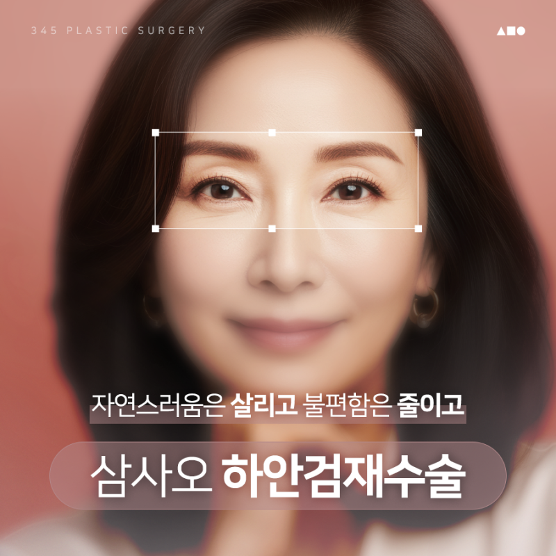 하안검 재수술, 더 신중한 접근이 필요한 이유