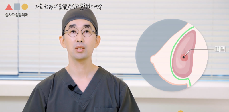 가슴수술 후 이런 증상이라면 병원에 내원해야 합니다 사진 4