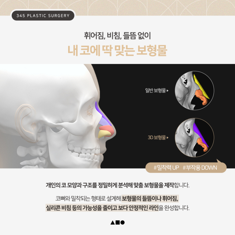 코수술 보형물 선택이 고민이라면? 삼사오 맞춤보형물 코성형 사진 3