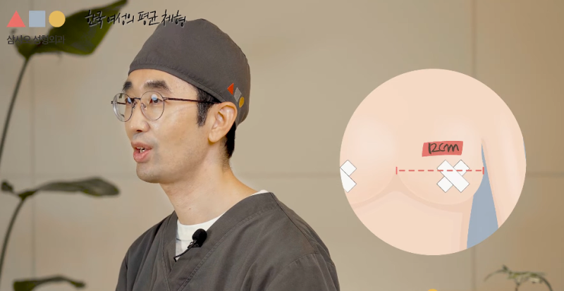 한국 여성들이 가장 많이 사용하는 가슴보형물? 종류부터 사이즈까지 사진 7