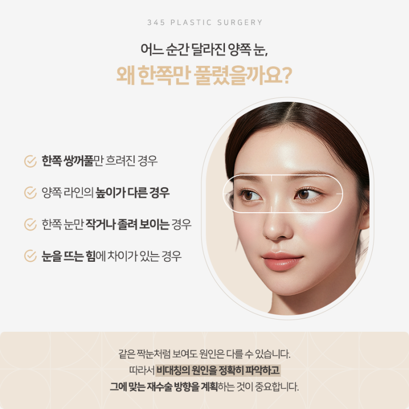 한쪽만 풀린 쌍꺼풀, 짝눈 교정 가능할까요? 사진 2