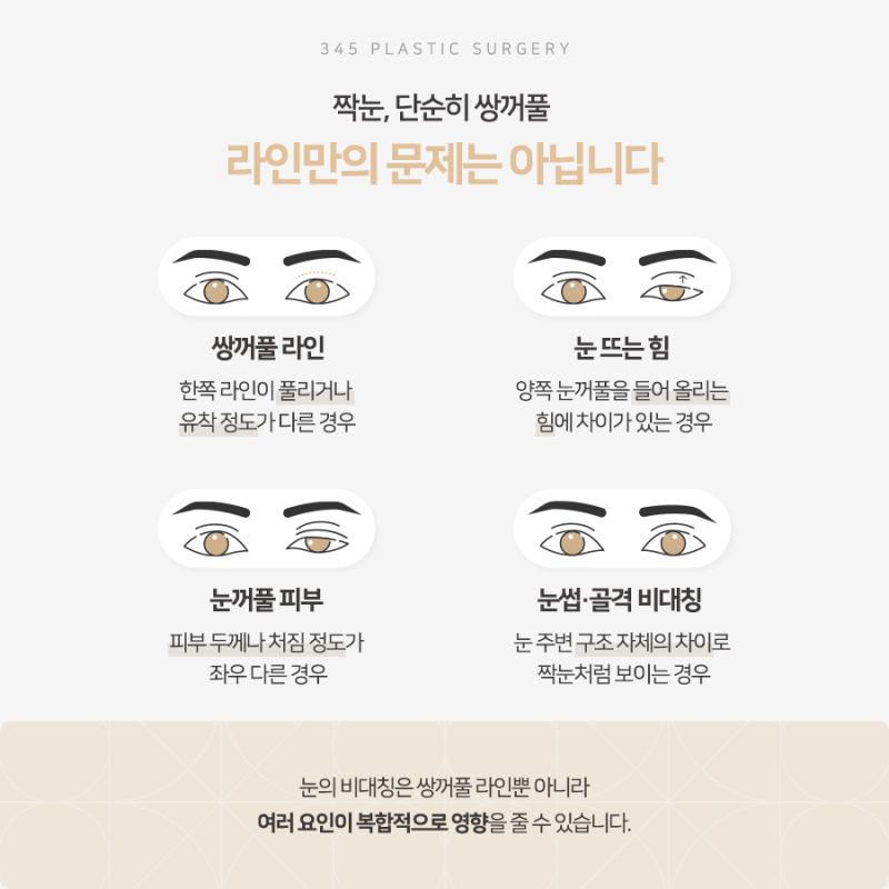 한쪽만 풀린 쌍꺼풀, 짝눈 교정 가능할까요? 사진 3