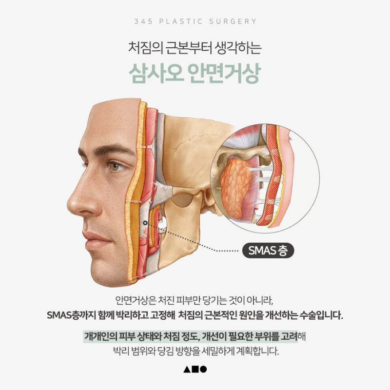 남자 안면거상, 처진 얼굴선이 고민이라면 확인할 점
