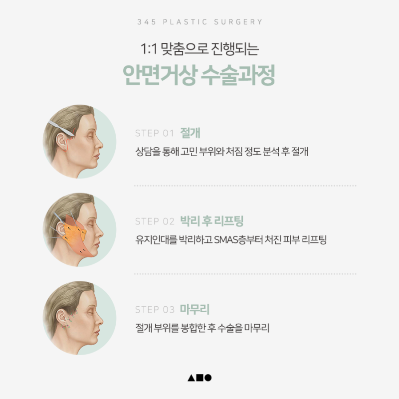 남자 안면거상, 처진 얼굴선이 고민이라면 확인할 점 사진 5