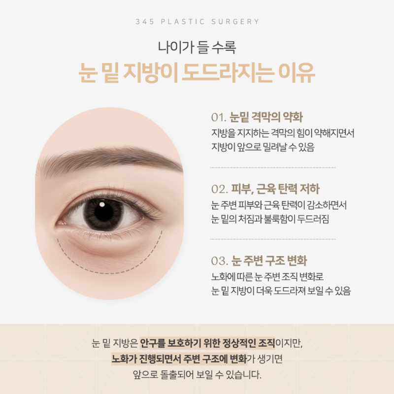 화장으로도 안 가려지는 눈 밑 그늘의 원인은? 삼사오 눈밑지방재배치 사진 2