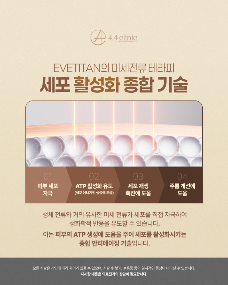 이브타이탄 (Eve Titan) 리프팅:  '탄력' 디자인 (레이저 리프팅 심층 분석)