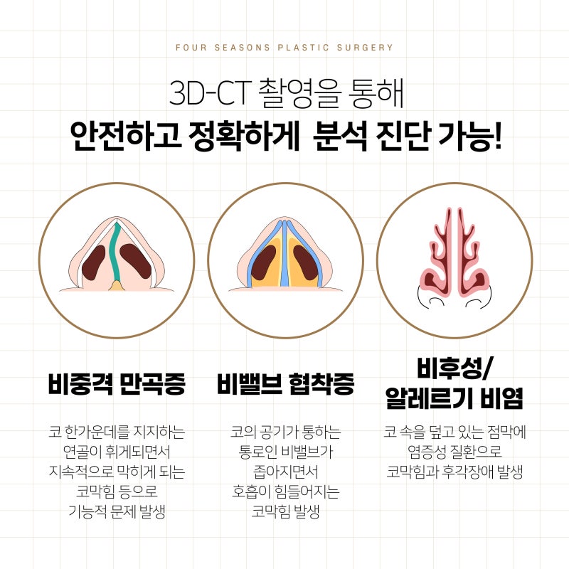 부산기능코 숨쉬기 편한 코, 모양만큼 중요한 이유