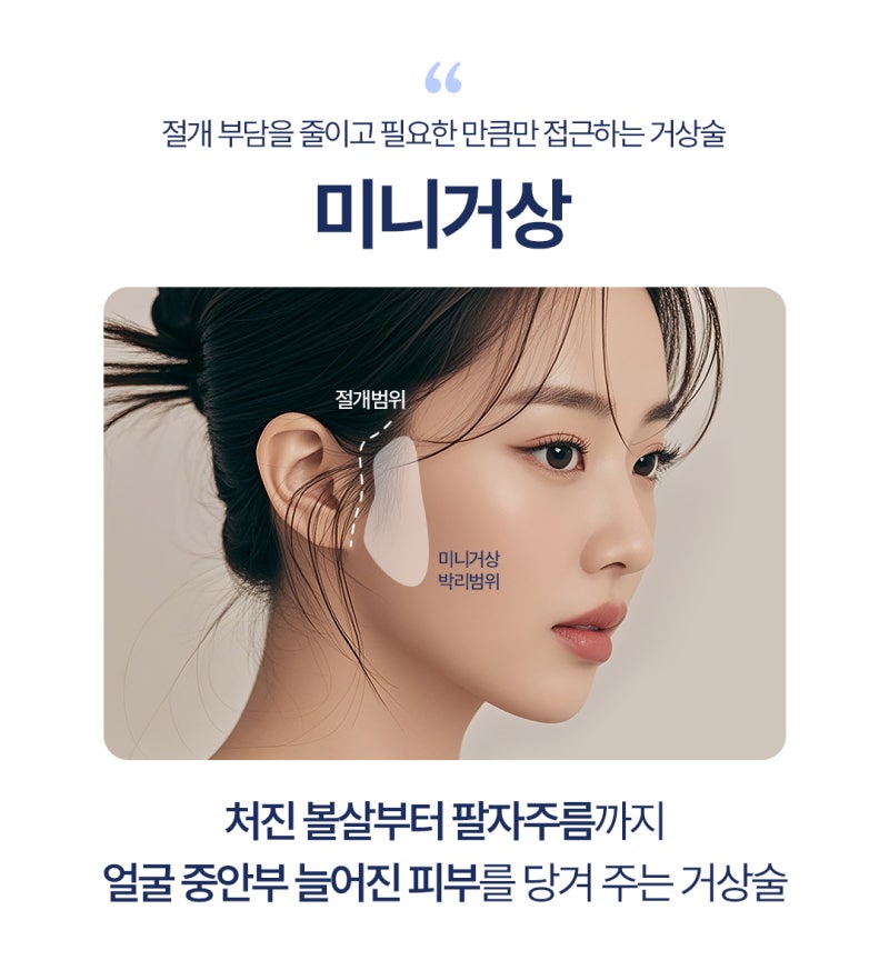 부산미니리프팅 흉터 부담을 줄인 미니거상