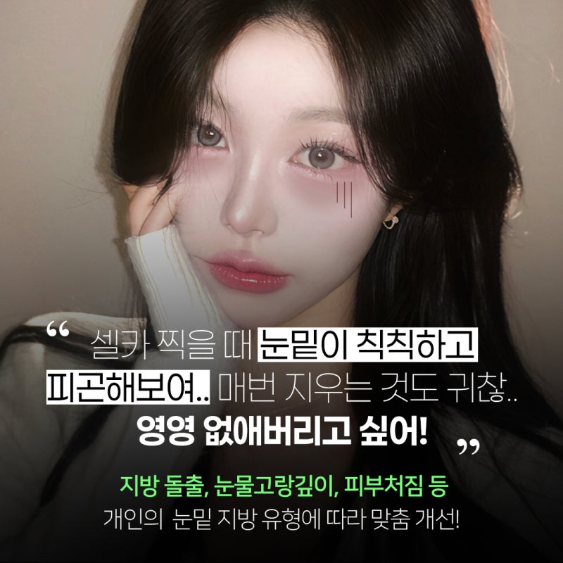 처지고 어두운 눈밑을 개선하는 눈밑지방재배치