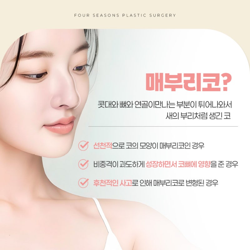 Lý do sử dụng mô tự thân trong phẫu thuật mũi gồ Busan