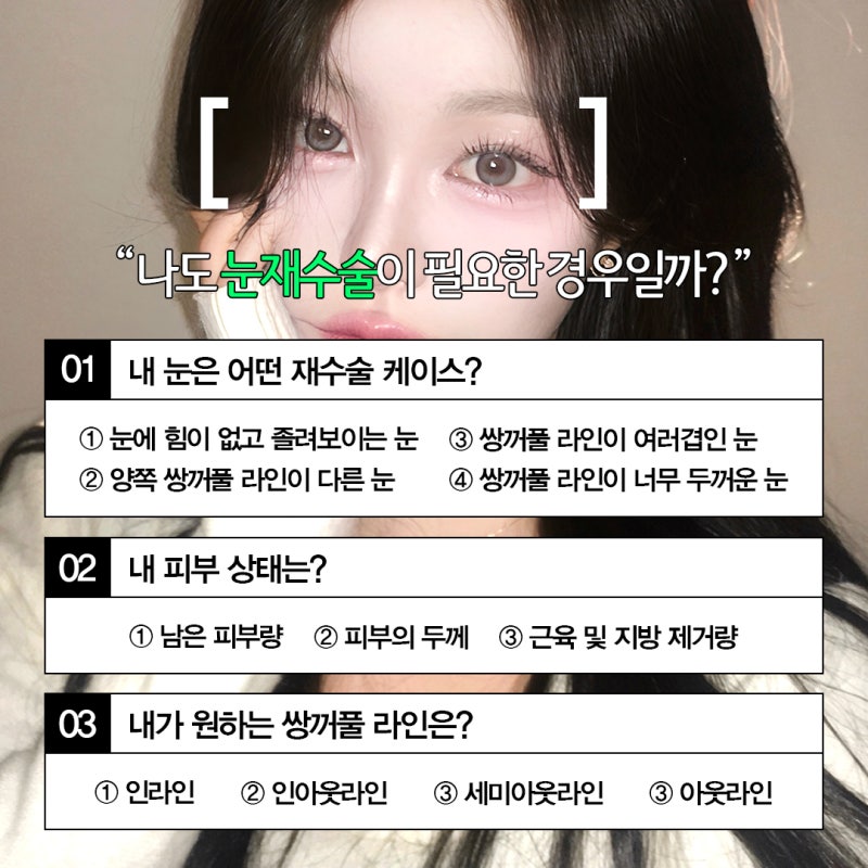 개인별 눈 상태 분석을 통한 맞춤형 쌍꺼풀재수술 방법은