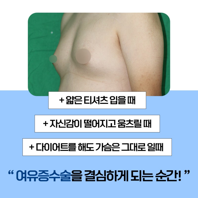 부산여유증 수술을 결심하게되는 계기