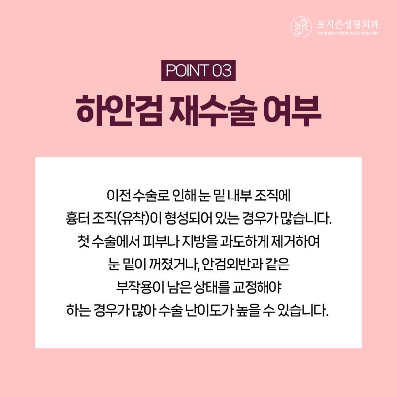 서면하안검수술 수술 비용이 달라지는 이유 사진 7