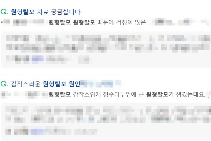 역삼역피부과 원형탈모, 갑자기 생기는 이유가 있습니다