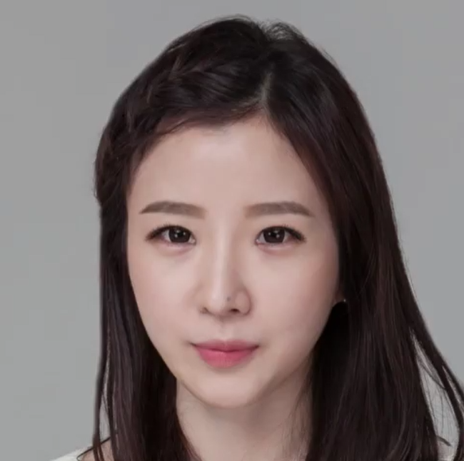 자연스러우면서 확실한 성형수술! 사진 2
