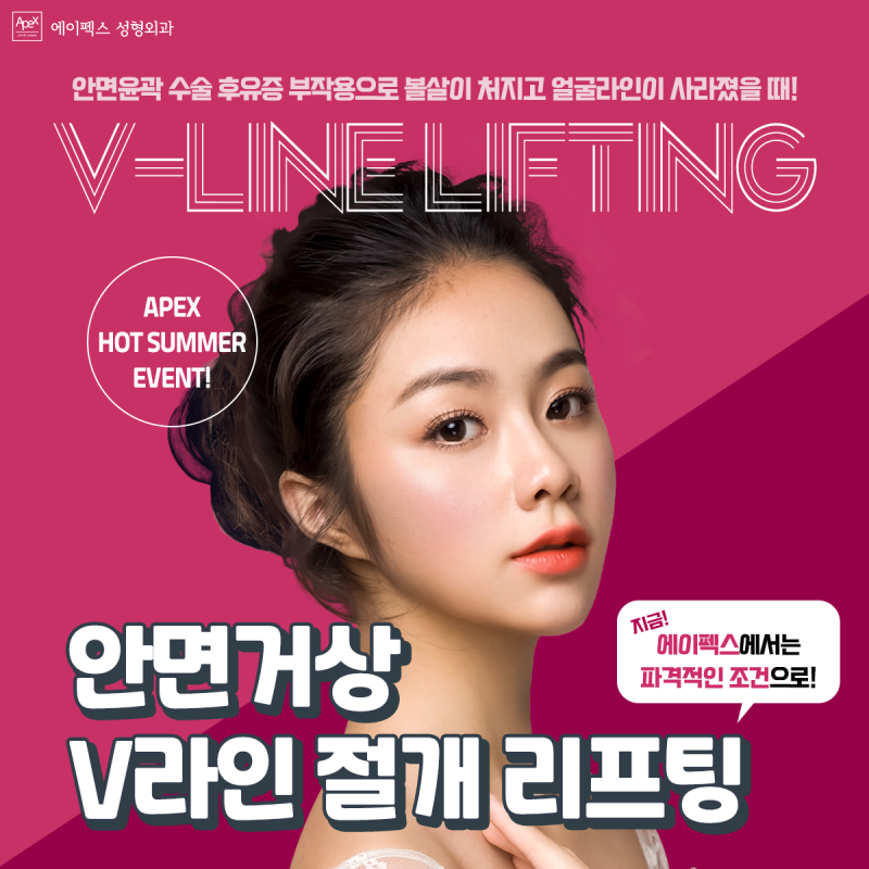 안면거상, 이마거상,확실한 변화가 있는 페이스리프팅 ☆에이펙스성형외과☆ 사진 4