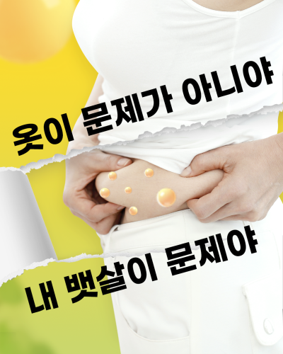 뱃살, 옆구리살, 에이펙스성형외과에서 지방흡입으로 매끈하게 정리햇! 사진 3