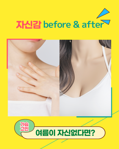 여름을 즐길 준비 됐어? 시원한 여름 휴가, 에이펙스성형외과에서! 사진 9