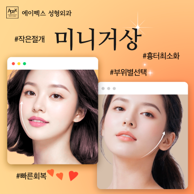 에이펙스성형외과, 날렵한 턱선, 탄력있는 V라인 "안면거상" 사진 6