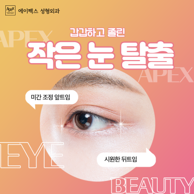 에이펙스성형외과 ♥눈성형, 코성형, 안면거상♥ 자연스럽고 확실한 변화! 사진 7