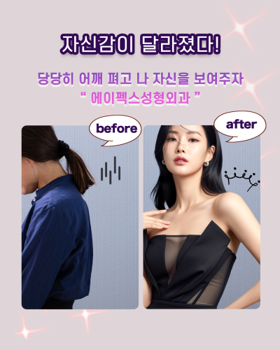 "에이펙스성형외과 송현석원장" 눈성형, 코성형, 안면거상 사진 4