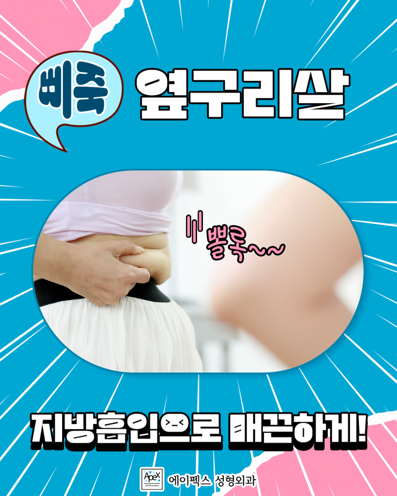 에이펙스성형외과에서 뱃살, 옆구리살, 지방흡입으로 매끈하게 정리하자!