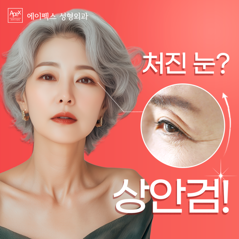 60세 이상이라면, 처진 눈꺼풀&볼록한 눈밑지방 "에이펙스성형외과 상안검&하안검"