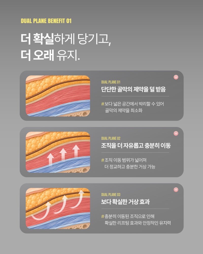 5포인트 절개는 그대로, 박리층은 다르게｜2세대 듀얼 플레인 이마거상 사진 6