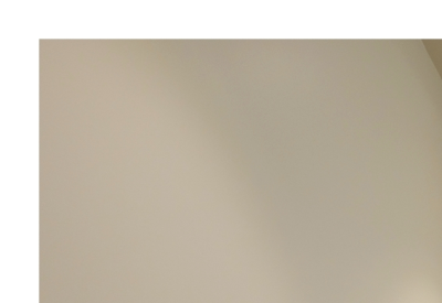 BBL레이저, 피부톤이 흐려질 때 고려하는 이유 사진 20