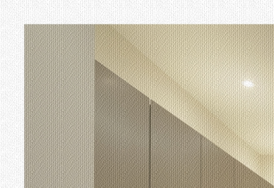 청담 모공줄이는시술, 코와 볼 모공이 넓어 보이는 원인과 버츄RF 사진 36