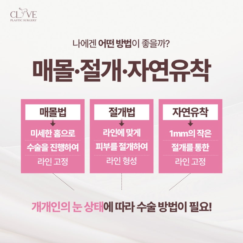 双眼皮修复手术做得好的医院，根据眼型选择适合自己的眼线