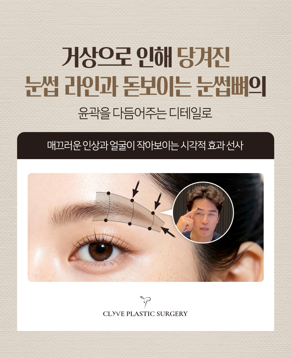 이마거상수술 후 다시 처질 수 있나요? 내시경이마거상 전 확인할 점 (역삼성형외과) 사진 9