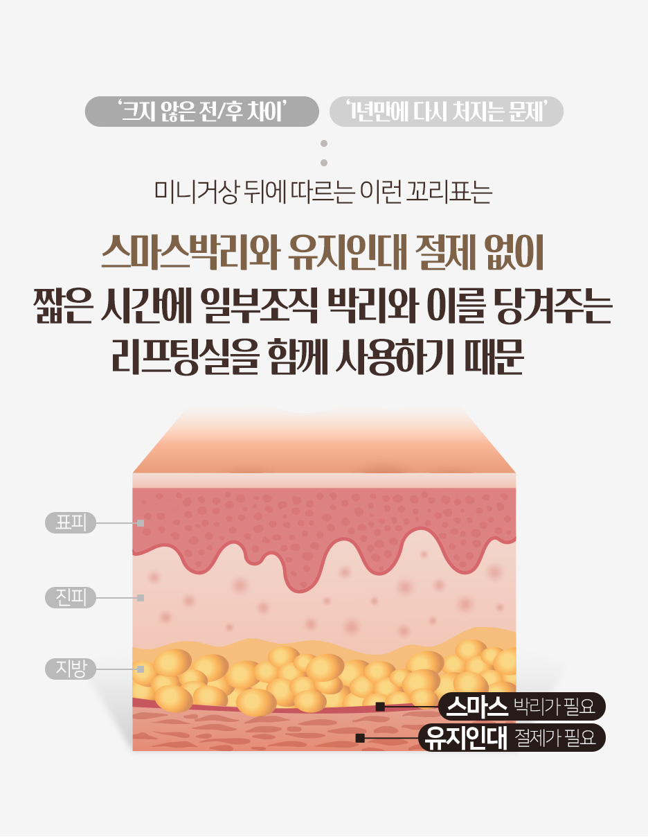 강남이마거상 비용부터 내시경이마거상 효과, 이마성형 차이까지 총정리 사진 5