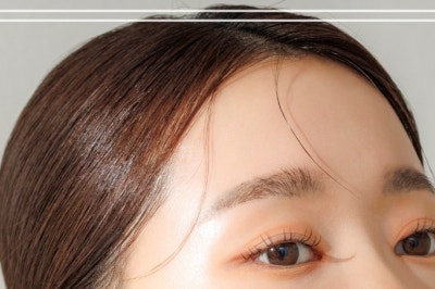 광대실리프팅·입꼬리실리프팅, 중안면리프팅이 필요한 얼굴은? 사진 17