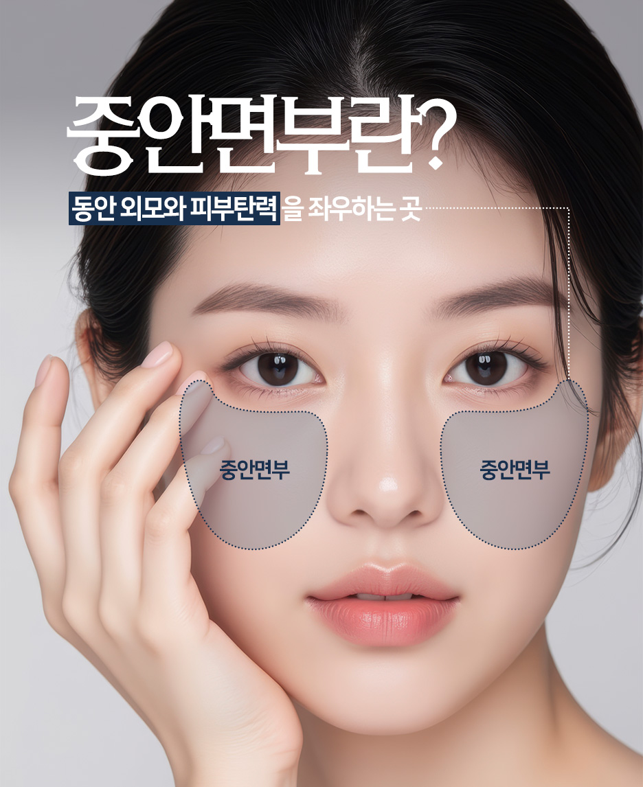 광대실리프팅·입꼬리실리프팅, 중안면리프팅이 필요한 얼굴은? 사진 3