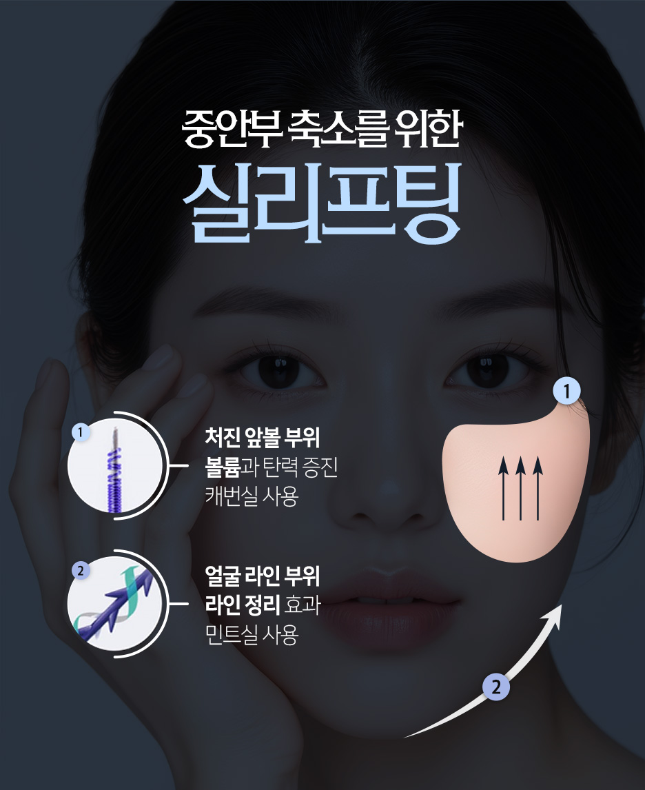 광대실리프팅·입꼬리실리프팅, 중안면리프팅이 필요한 얼굴은? 사진 4