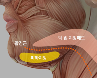 턱살, 옆선라인 확실한 교정 방법! 사진 8